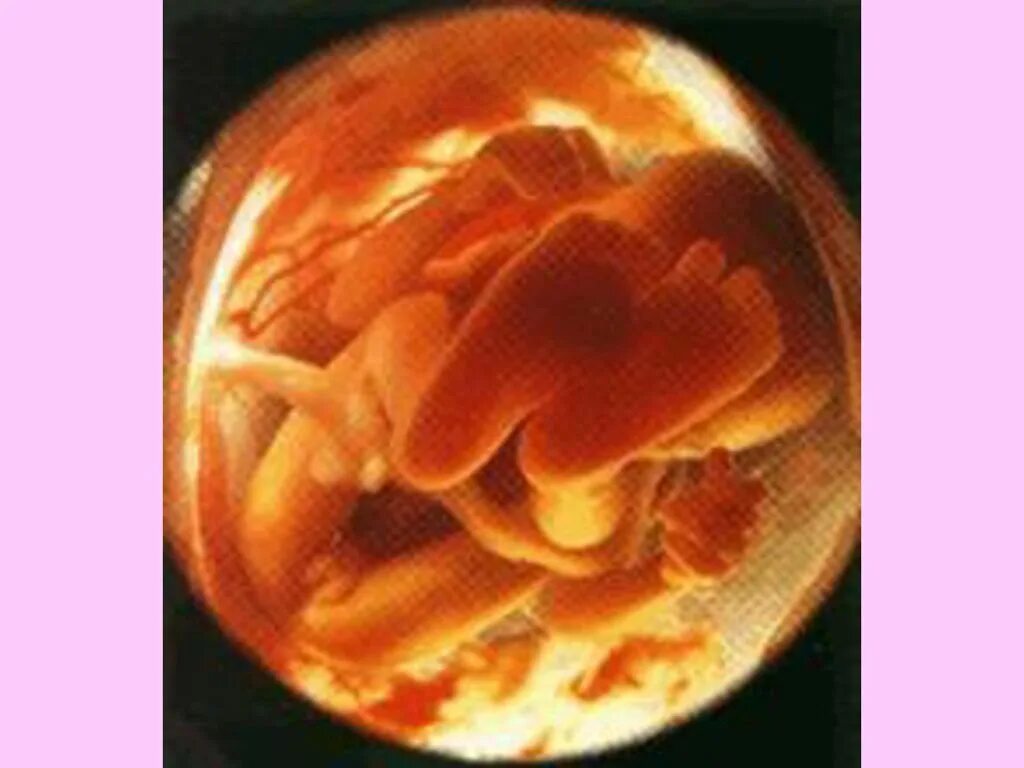 малыш на 19 неделе беременности. малыш на 20 неделе беременности. фото ребёнка на 20 неделе беременности в животе узи. ребёнок на 20 неделе беременности. живот на 20 неделе беременности.