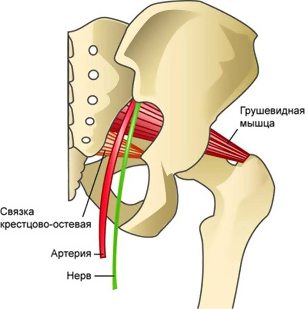 Лечение грушевидной мышцы тазобедренного сустава