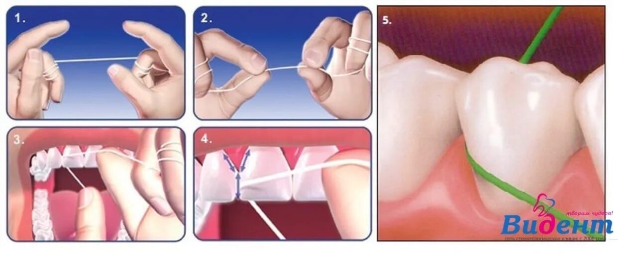 Можно греть зуб. Техника пользования зубной нитью. Техника чистки зубов нитью. Использование зубной нити. Правильное использование зубной нити.