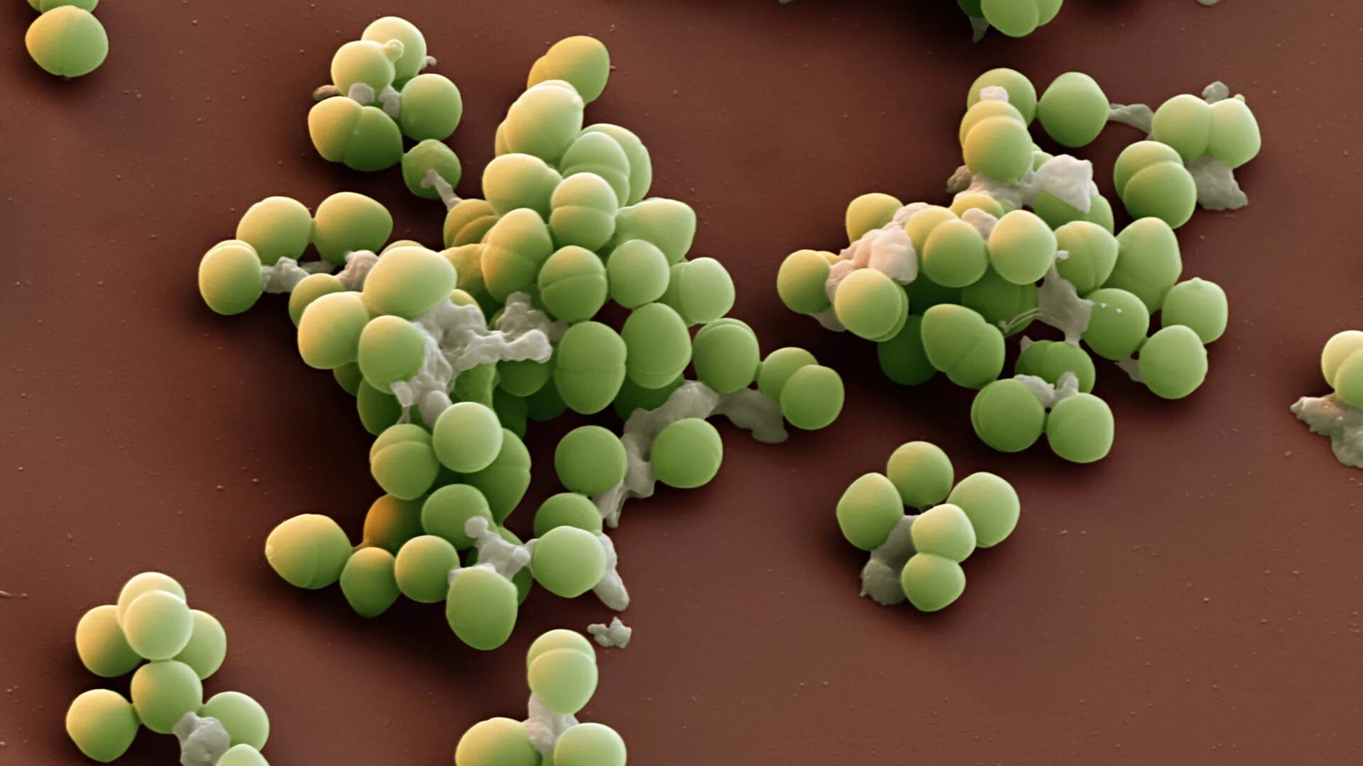 Энтерококки бактерии. Энтерококки faecalis. Энтерококкус фекалис. Стафилококки стрептококки энтерококки. Энтерококк faecium.