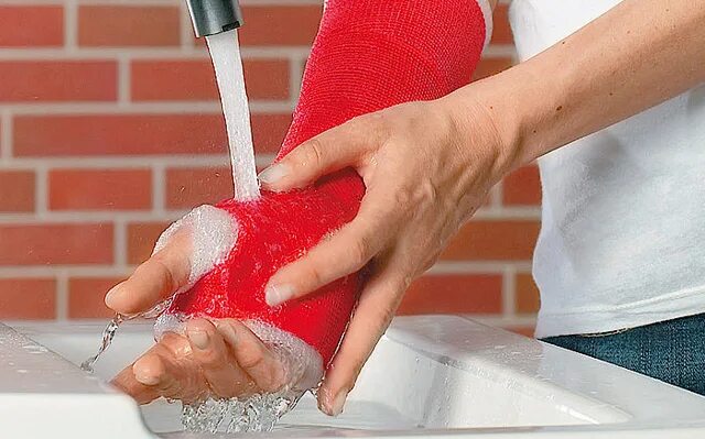 Тутор турбокаст. Перелом пяточной кости гипсовая лонгета. Ортез на голеностоп turbocast (турбокаст). Целлакаст бинт. Ортез бауэрфайнд голеностоп ахилл.