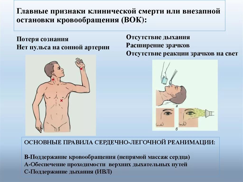 Определите признаки клинической смерти. Признаки клинической смерти. Признаки клинической сметр. Признаки клиническойсмерьти. Клиническая смерть признаки клинической смерти.