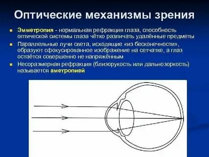 H 52.5 нарушения аккомодации