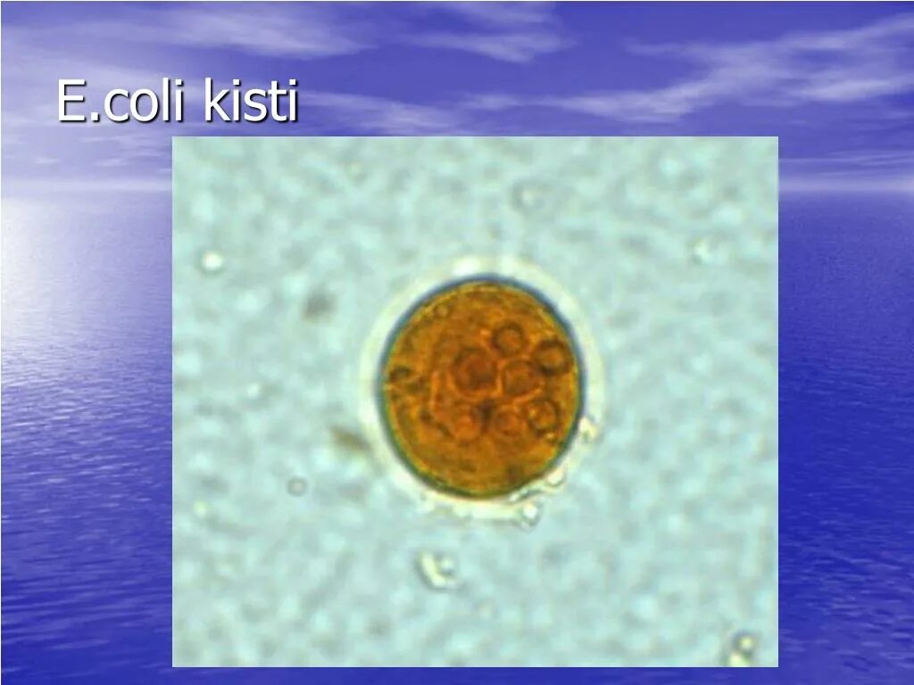 Цисты Entamoeba. Entamoeba coli циста. Entamoeba histolytica циста в Кале. Entamoeba coli в кале