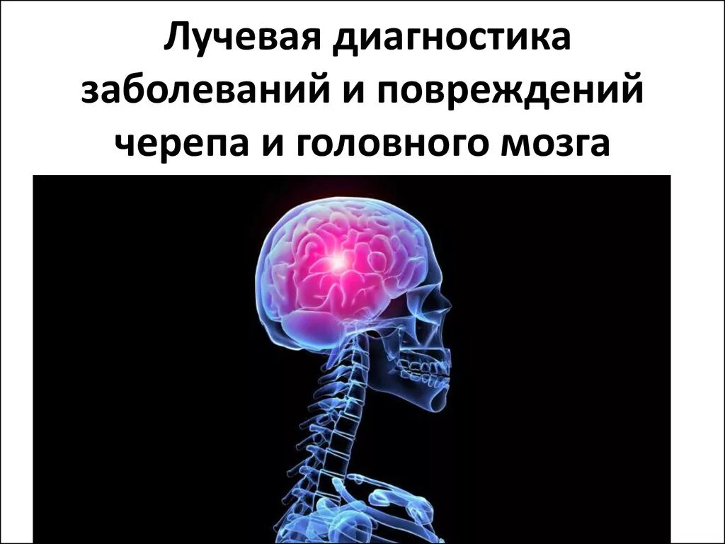 Поражение головного мозга диагноз. Лучевая диагностика заболеваний головного мозга. Рентгенодиагностика заболеваний головного мозга. Лучевая диагностика черепа. Лучевые методы исследования головного мозга.