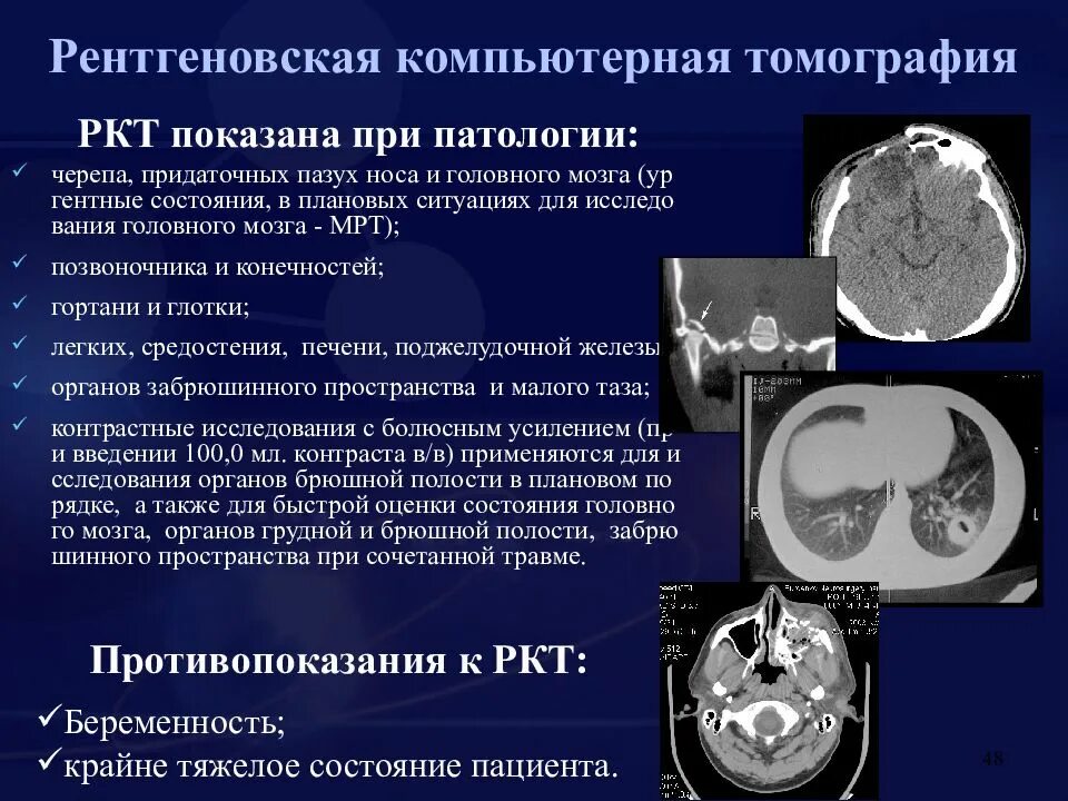 Что такое ркт. Преимущества РКТ при исследовании органов грудной полости.. Рентгеновская компьютерная томография. Рентгеновская компьютерная томография (РКТ). Понятие о компьютерной томографии.