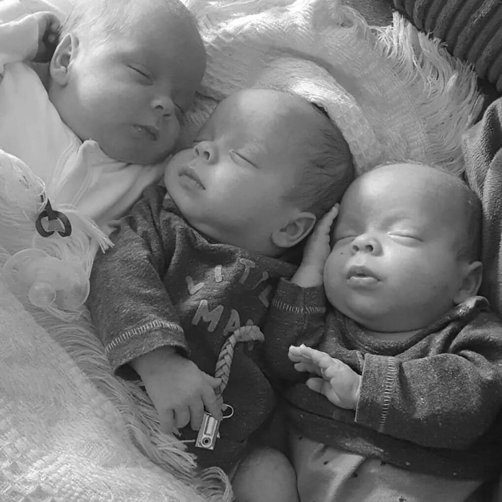 Рождение 3 близнецов