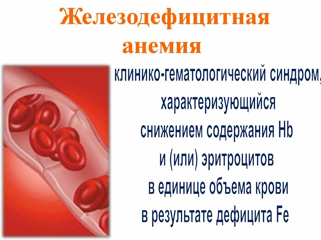 Железодефицитная анемия этиология. Этиология жда. Железодефицитная анемия этиология патогенез. Патогенез железодефицитной анемии. Анемия железодефицитная причины лечение