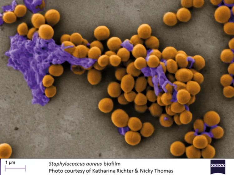 Staphylococcus aureus золотистый стафилококк. Стафилококк ауреус микроскоп. Коагулазоположительный стафилококк. Золотистый стафилококк коагулазоположительный. Стрептококк ауреус.