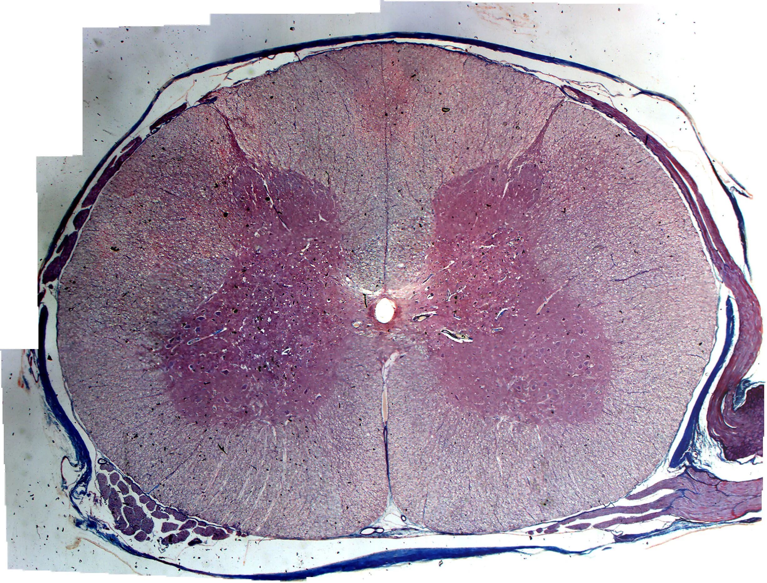Тело нечленистое округлое поперечное. Спинной мозг препарат гематоксилин. Спинной мозг гистология препарат. Срез спинного мозга препарат. Спинной мозг гематоксилин эозин.