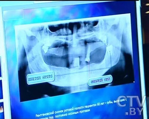 Матрица гаряева зубы. Чистые матрицы гаряева. Матрица гаряева противопаразитарная программа. Матрица гаряева зубы. Матрица гаряева зубы.