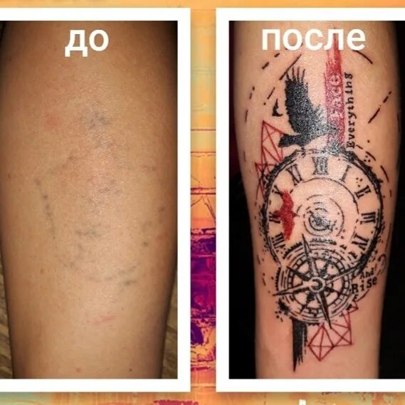 Через сколько пить после тату. Исправление татуировок. Перекрытие шрамов татуировкой. Тату до и после заживления.