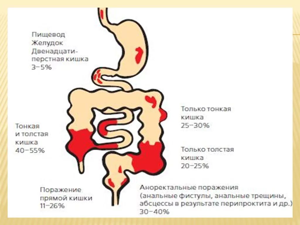 Какая температура в кишечнике человека. Синдром кишечной диспепсии презентация. Желудок 12 перстная кишка толстая кишка. Пищевод и 12 перстной кишки. Кишечник с желудком и 12 перстной кишкой.