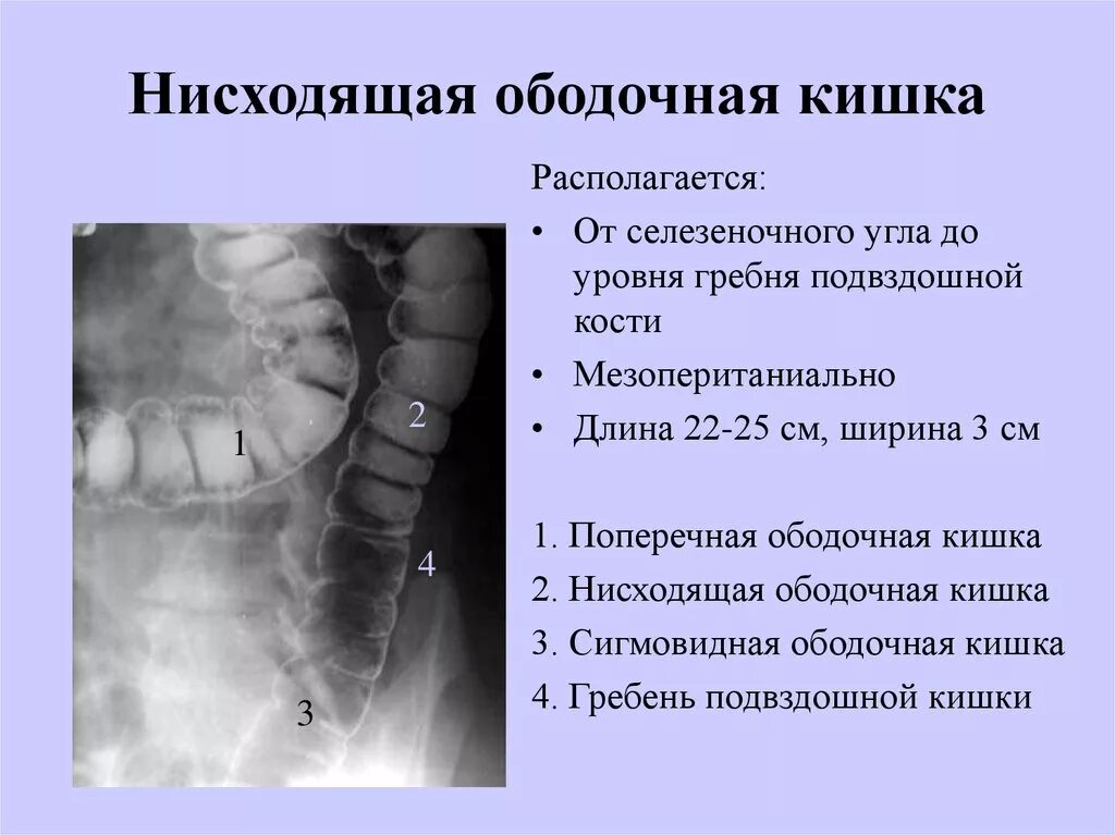 Строение ободочной кишки анатомия. Поперечная ободочная кишка анатомия. Отделы нисходящей ободочной кишки. Анатомическое подразделение ободочной кишки. Боль в слепой кишке