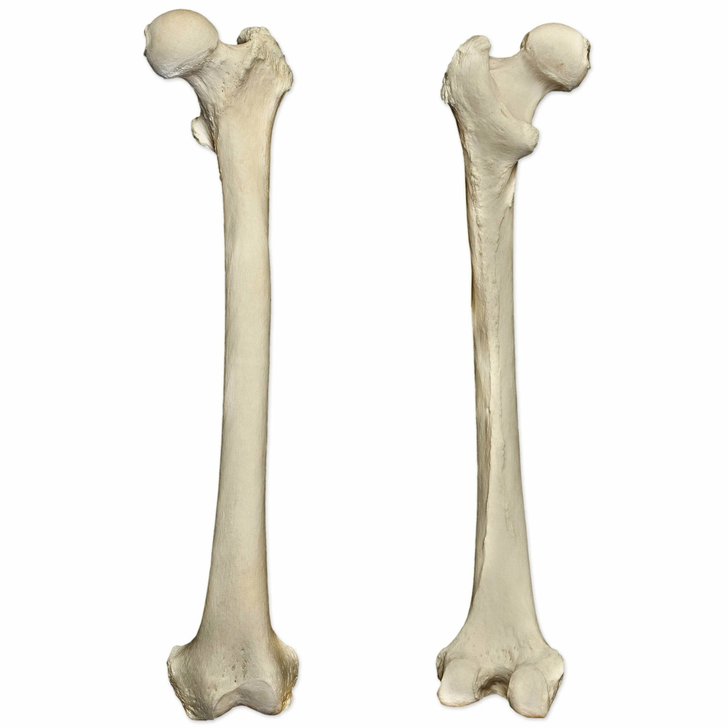 Femur анатомия. Левая бедренная кость анатомия. Бедренная кость (femur). Бедренная кость на скелете человека. Ковид кости