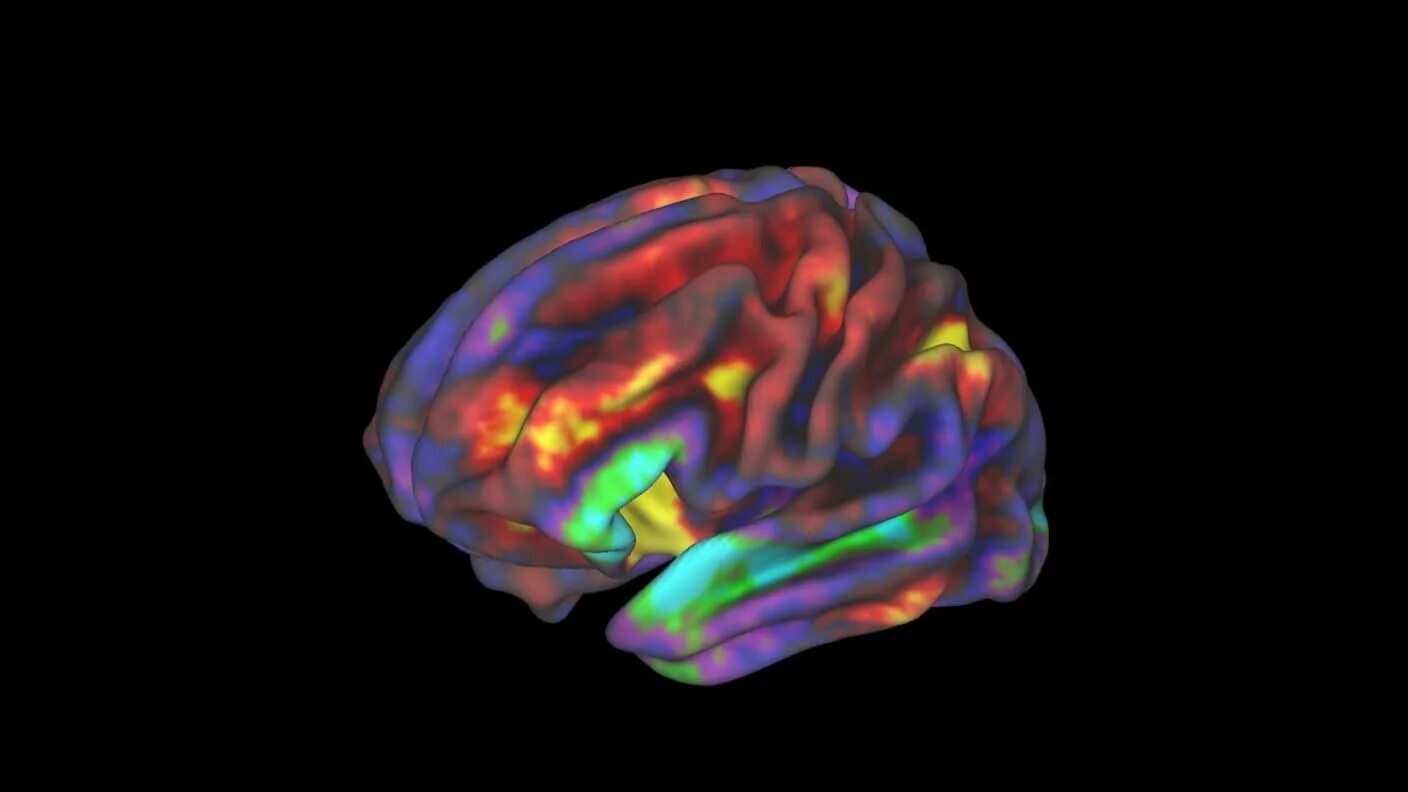 3d Atlas Brain. 3d Brain ai. 3d Нейровизуализация это.