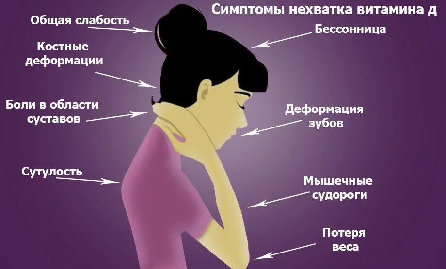 Как называется нехватка. Симптомы при недостатке витамина д. недостаток витамина д симптомы. симптомы при нехватке витамина д. как понять что нехватка витамина д в организме человека.
