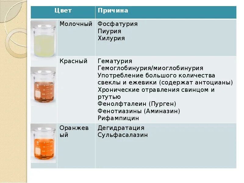 Изменение цвета и запаха мочи. Нормальный цвет мочи. Изменение цвета мочи. Изменился цвет мочи.