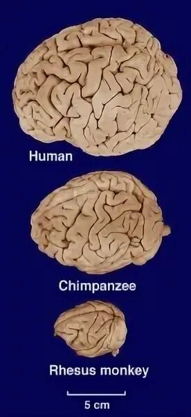 Мозг гориллы и человека. Мозг шимпанзе после экстази. Как выглядит мозг шимпанзе.