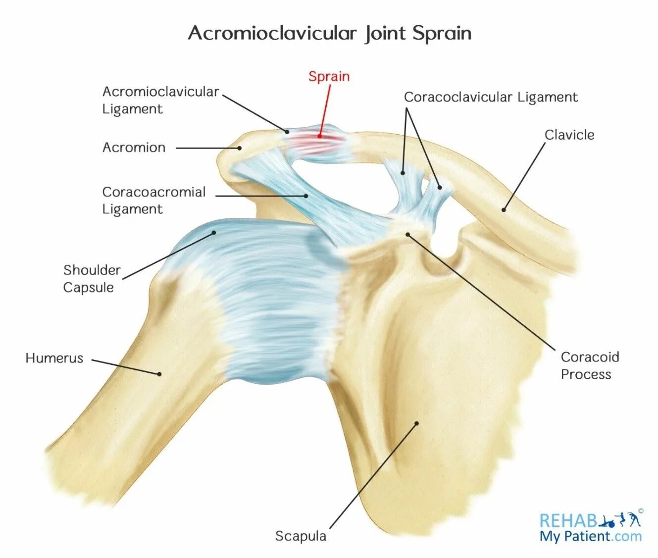 Плечевые связки. Связки плечевого сустава анатомия. Acromioclavicular ligament. Связки акромиально-ключичного сустава. Плечего ключичный сустав.