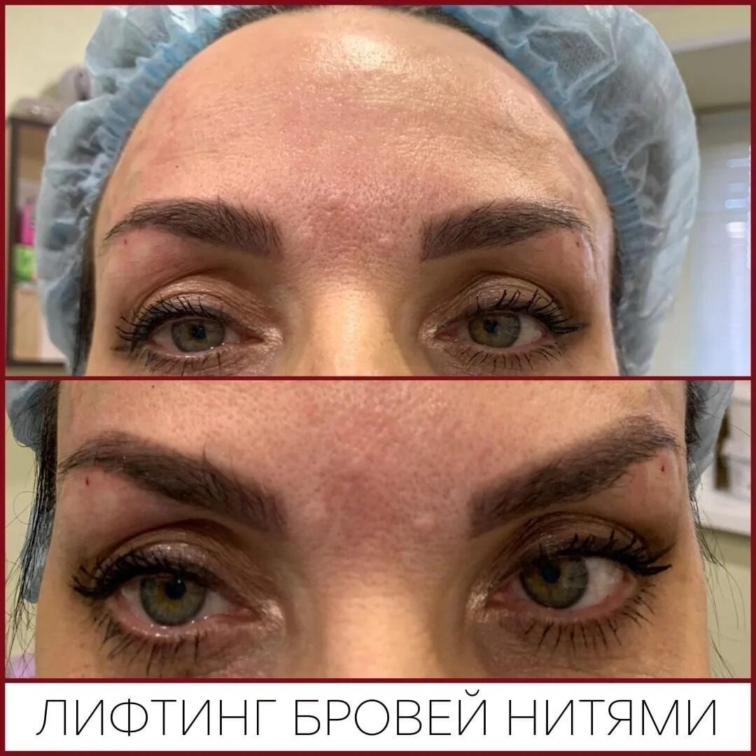 Лифтинг бровей: найдено 89 изображений