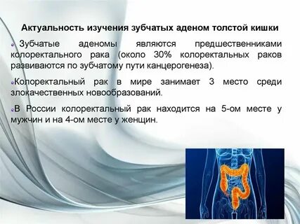 Дисплазия толстой кишки 2 степени