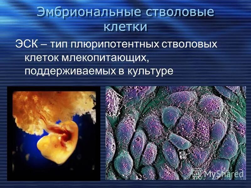 Эмбриональные стволовые клетки