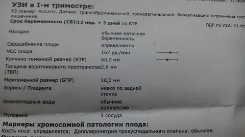 Пдр по узи