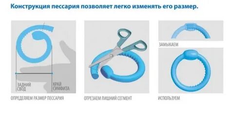 Как подобрать размер кубического пессария