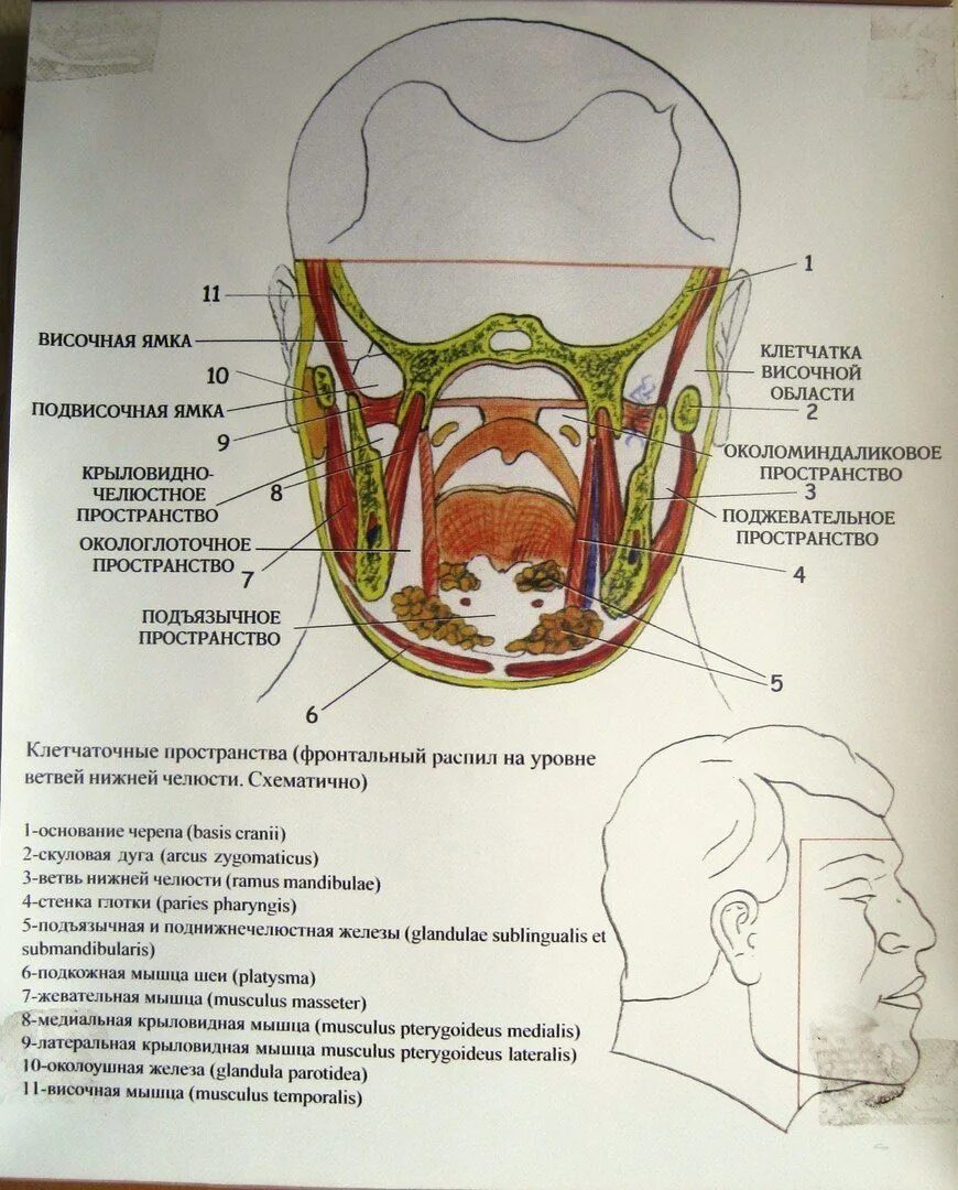 Пространства полости рта. Боковое клетчаточное пространство дна полости рта. Схема Рудько флегмон. Клетчаточное пространство дна полости рта анатомия. Окологлоточное клетчаточное пространство схема.