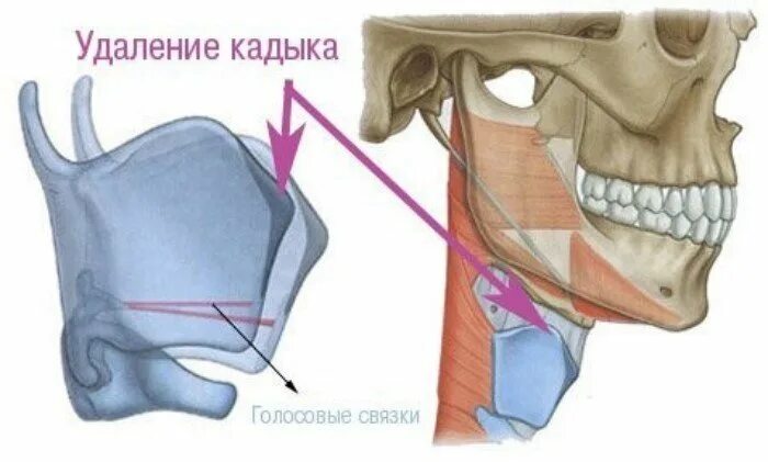 Почему виден кадык. Кагык. Адамово яблоко гортань.