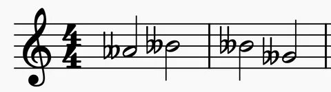 U qolini ushlab, siydiradi.