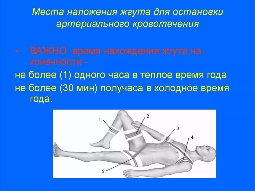 Сколько держать артериальный жгут. Какова Продолжительность наложения кровоостанавливающего жгута. Жгут резиновый для остановки артериального кровотечения. Время наложения жгута в зимнее время. Наложение жгута для остановки.