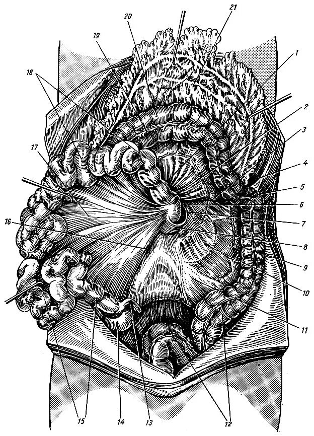 корень брыжейки. корень брыжейки тонкой кишки анатомия. брыжейка поперечной ободочной кишки. брыжейка поперечной ободочной кишки. корень брыжейки ободочной кишки.