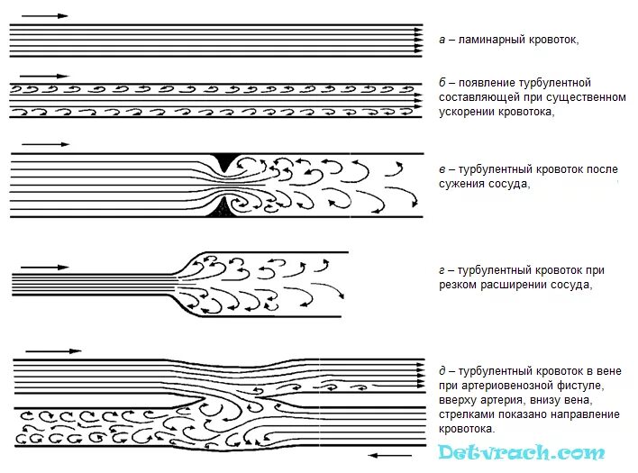 ламинарный поток крови. ламинарный характер кровотока это. турбулентный кровоток. цветовой допплер понятие. турбулентный кровоток.