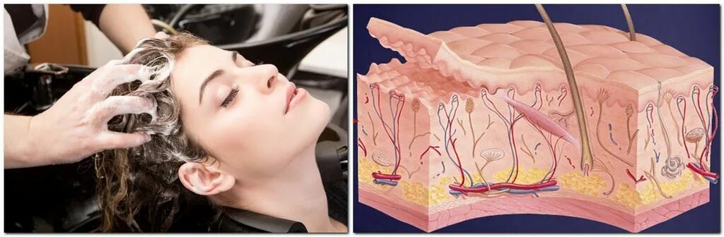 Скрабирование кожи головы. Пилинг головы до после. Пилинг головы до после. Кожа головы до пилинга. Скрабирование кожи головы.