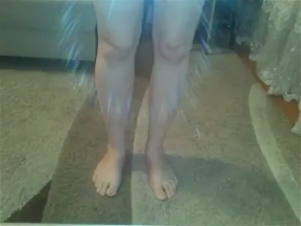 толстые ноги у девушки. одна голень толще другой причины. стройные и ровные ноги. почему одна нога толще. толстые щиколотки.