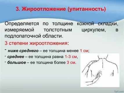 Кожная складка