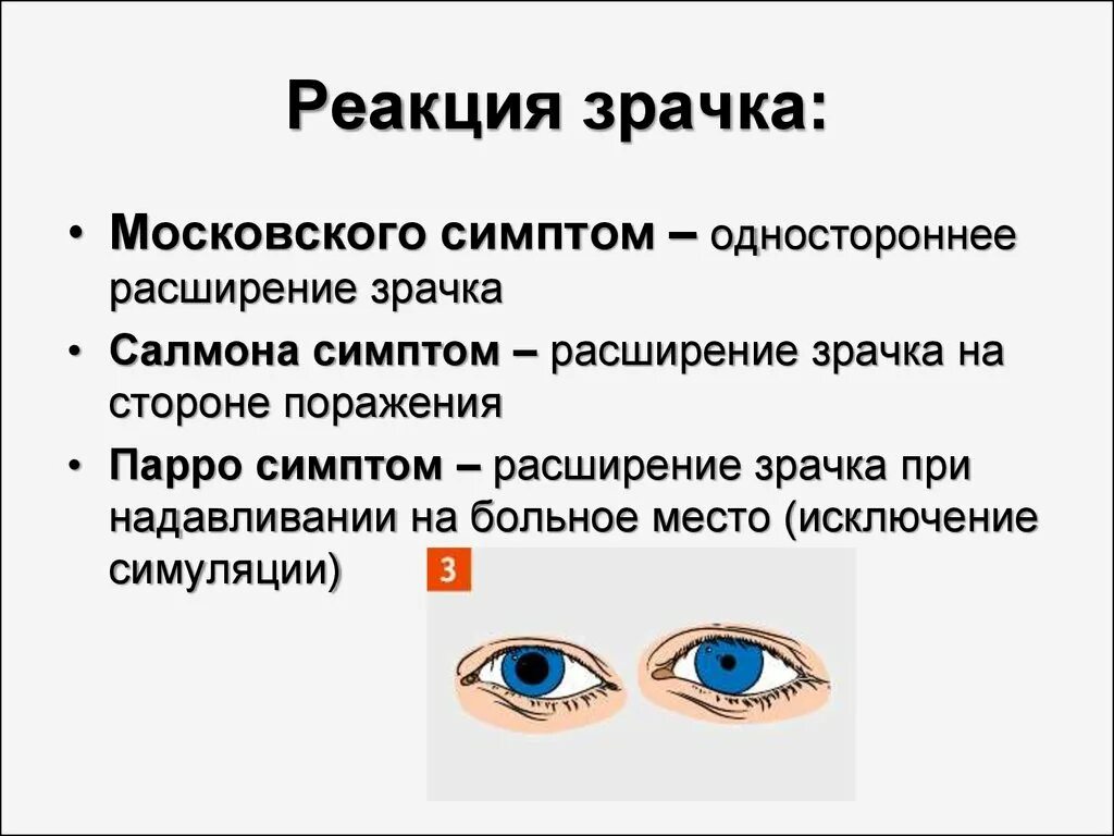 Расширение зрачка какой отдел. Оценка реакции зрачков на свет. Расширенные зрачки не реагируют на свет.