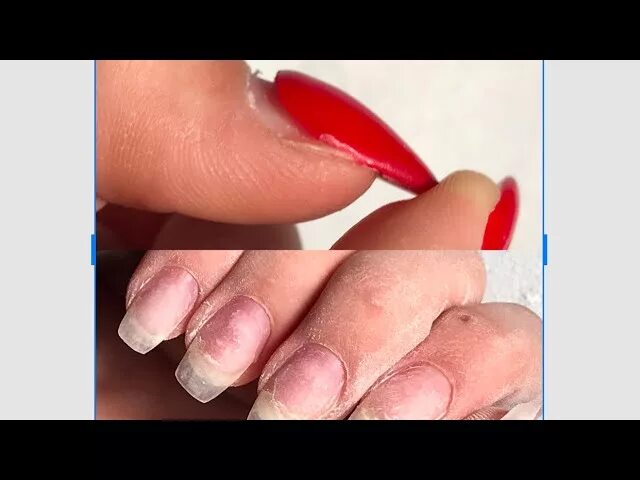 Почему отходит гель. Отходит гель от ногтей у кутикулы. отслойка гель лака у кутикулы. отслойка гель лака возле кутикулы.