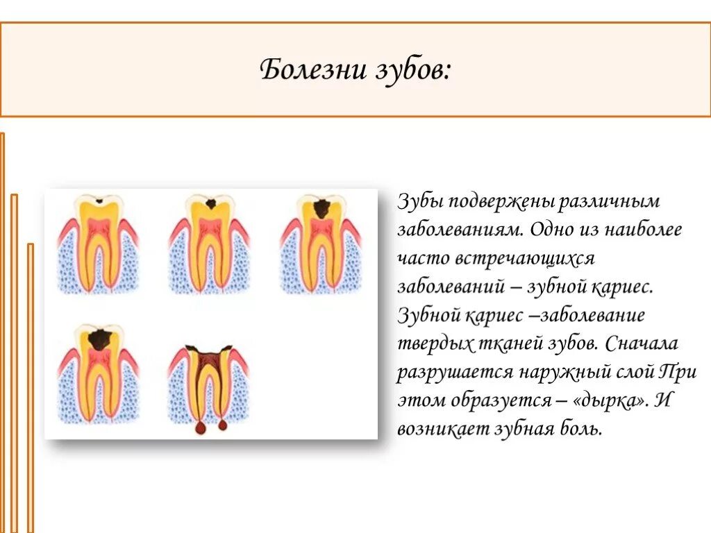 Болезни на букву к. Зубная болезнь на букву п. Заболевание зуба на букву п. Стадии заболевания зубов.