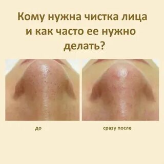 Как правильно делать чистку лица дома