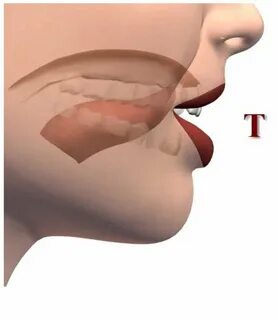 T sound