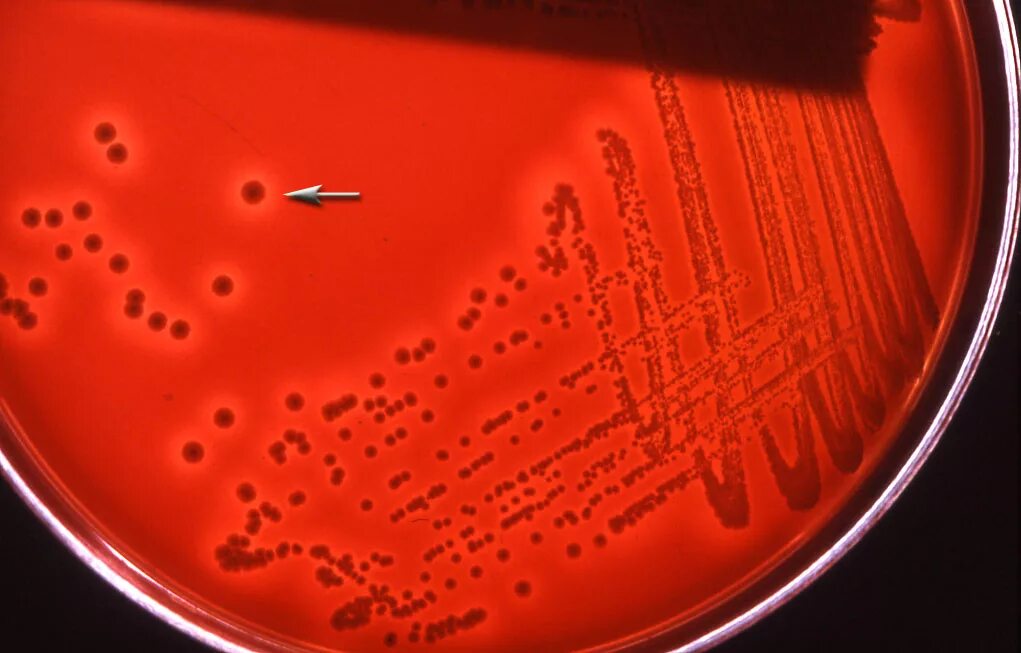 Listeria rj. Yersinia enterocolitica. listeria monocytogenes микроскопия. yersinia pseudotuberculosis микроскопия.