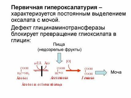 Гипероксалурия