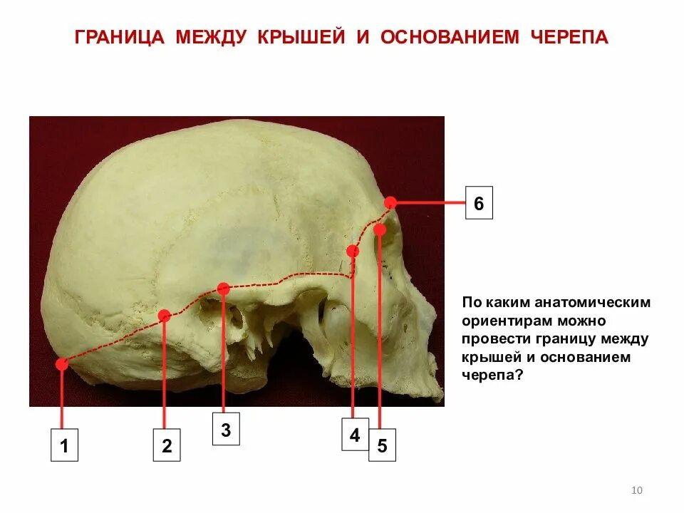 Основание черепа где. Свод черепа сбоку. Граница свода и основания черепа. Граница между сводом и основанием черепа. Граница между крышей и основанием черепа.