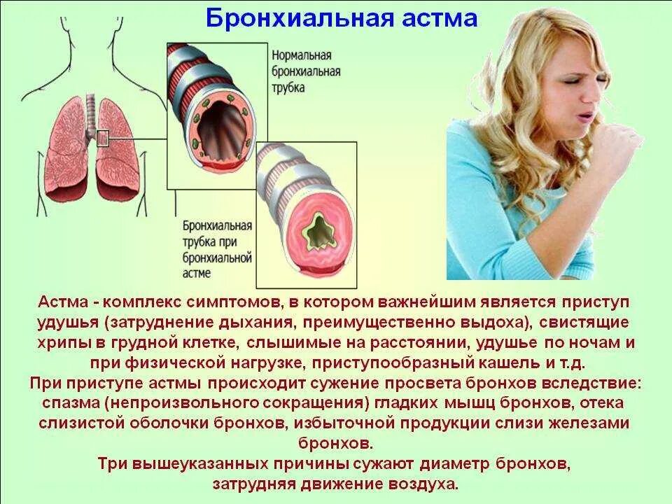 Что такое астматик