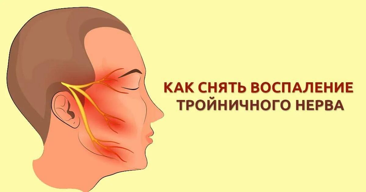 Поражение тройничного нерва неврология. Ветви тройничного нерва и зоны иннервации. Немеет левая челюсть. Артроз челюстно-лицевого сустава. Ризотомия тройничного нерва.