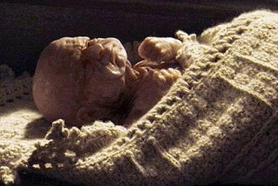 Загадочная жизнь бенджамина баттона. Бенджамин баттон. Ребенок старый молодеет. Загадочная история бенджамина баттона фильм. Тильда суинтон бенджамин баттон.