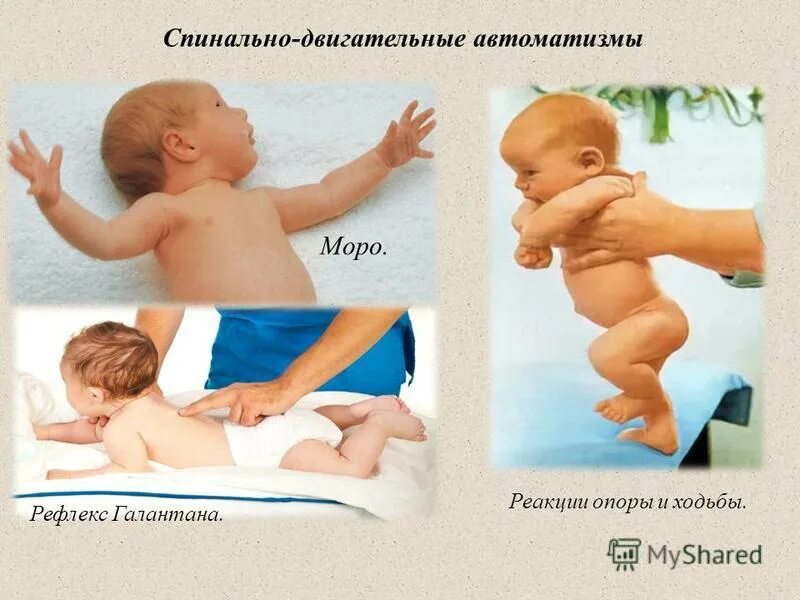 Норма рефлекса Моро у новорожденных. Рефлекс Монро новорожденных. Рефлекс опоры новорожденного. Двигательные рефлексы новорожденных.